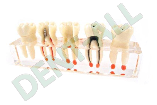 Transparent Molar Educational Model