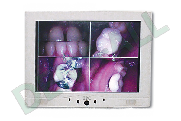 TPC Dental LCD Multi-Media 15