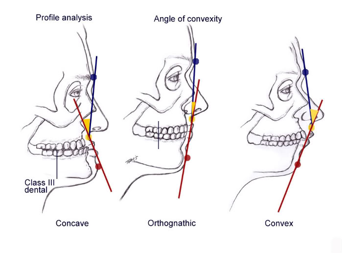 cirurgia-ortogn-tica