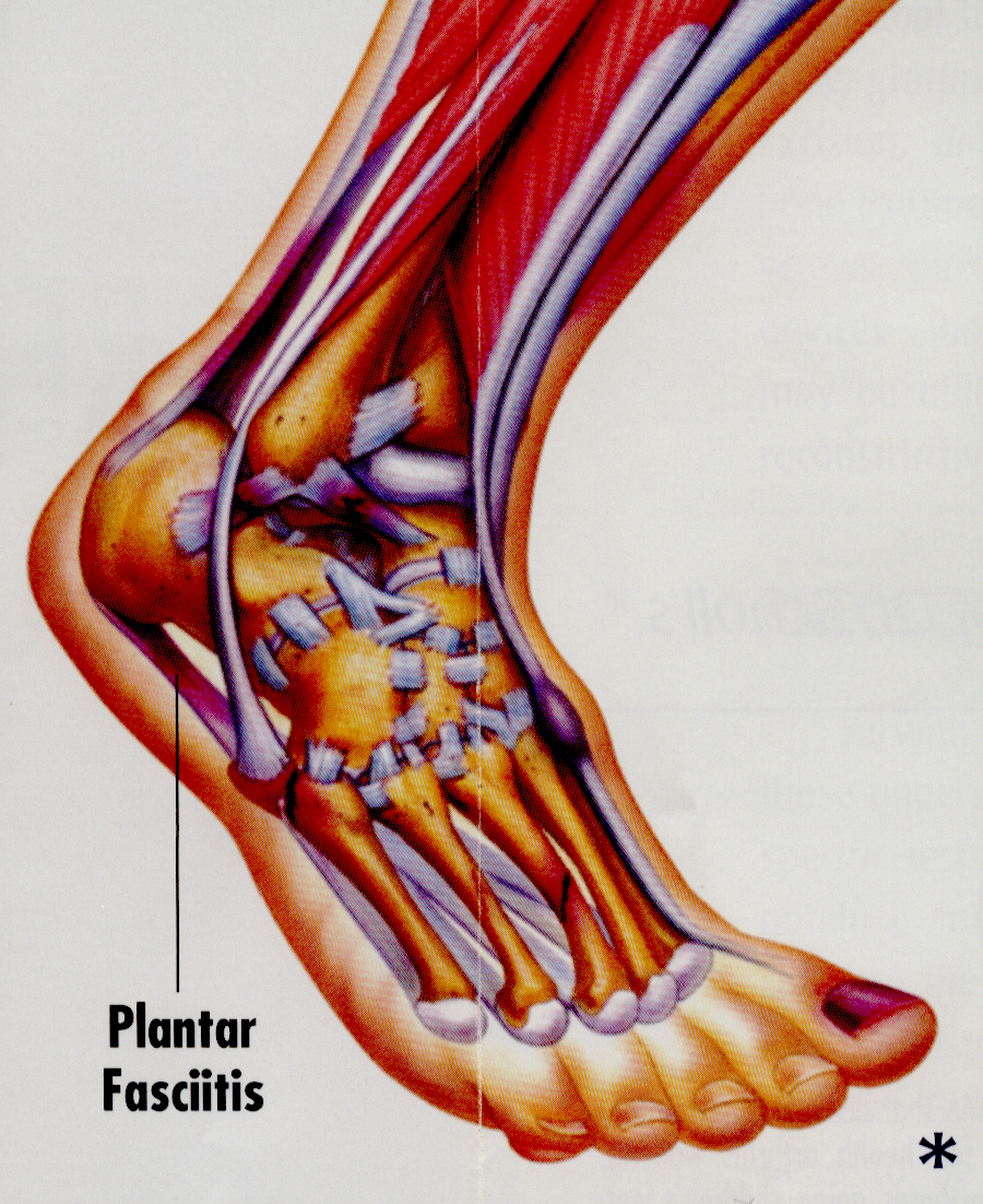 Forefoot and Rearfoot Surgery